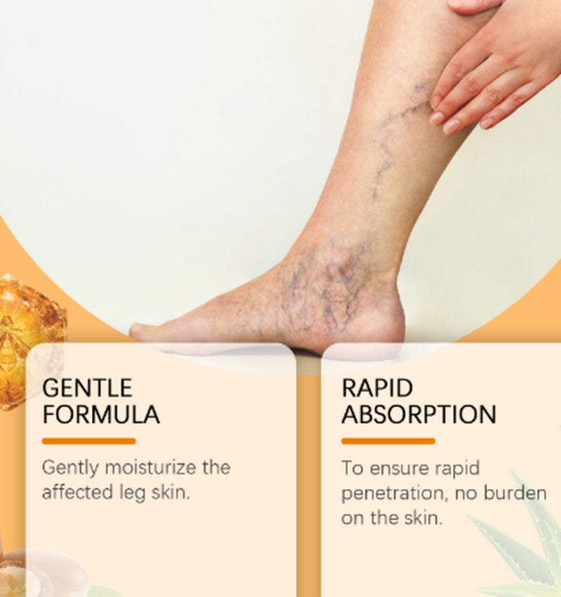 Leg Care Spray for Daily Relief of Leg Varicosity